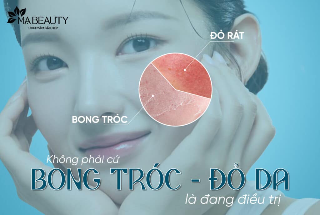 Liệu Trình Trị Nám Không Bong Tróc Tại Mạ Beauty – Phục Hồi Da Từ Gốc, Hiệu Quả Bền Vững